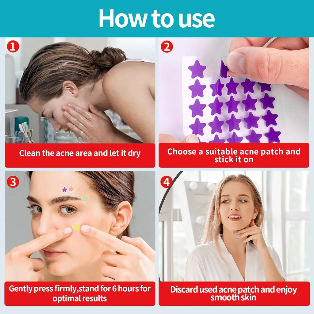 Pimple Patches for Face, Hydrocolloid Acne Patches, Cute Star Zit Covers, Colorful Superstar Patches Spot Stickers, 357 Count | 4 Sizes (8Mm/9Mm/11Mm/14Mm)